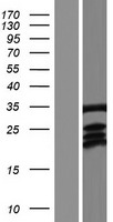 LDB3 Human Over-expression Lysate