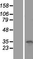 OCIAD1 Human Over-expression Lysate
