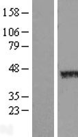 TMEM183BP Human Over-expression Lysate