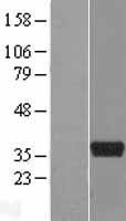 ART5 Human Over-expression Lysate