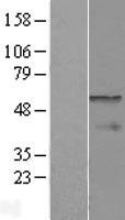 CPEB1 Human Over-expression Lysate
