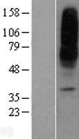 ENT1 (SLC29A1) Human Over-expression Lysate