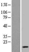 RTL8B Human Over-expression Lysate