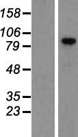 VCAM1 Human Over-expression Lysate