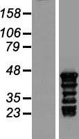TSPY3 Human Over-expression Lysate