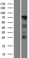 AGAP7P Human Over-expression Lysate