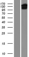URG4 (URGCP) Human Over-expression Lysate