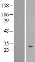 C3orf43 (SMCO1) Human Over-expression Lysate