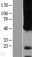 APH1A Human Over-expression Lysate