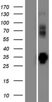 VPS37D Human Over-expression Lysate