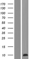 PRCD Human Over-expression Lysate