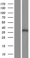 Constitutive androstane receptor (NR1I3) Human Over-expression Lysate