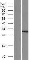 Constitutive androstane receptor (NR1I3) Human Over-expression Lysate