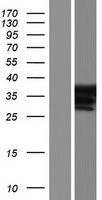 Constitutive androstane receptor (NR1I3) Human Over-expression Lysate