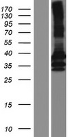 Constitutive androstane receptor (NR1I3) Human Over-expression Lysate