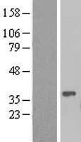 Constitutive androstane receptor (NR1I3) Human Over-expression Lysate