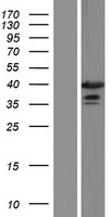 Constitutive androstane receptor (NR1I3) Human Over-expression Lysate