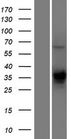 TMEM231 Human Over-expression Lysate