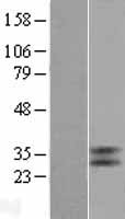GPBAR1 Human Over-expression Lysate