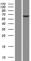 Fascin 2 (FSCN2) Human Over-expression Lysate