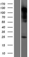 Serotonin N acetyltransferase (AANAT) Human Over-expression Lysate
