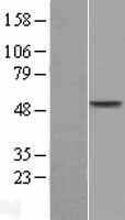 AADAC Human Over-expression Lysate