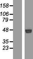 ROR1 Human Over-expression Lysate