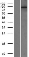 POTEE Human Over-expression Lysate