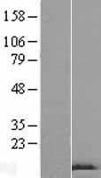 GnRH (GNRH1) Human Over-expression Lysate