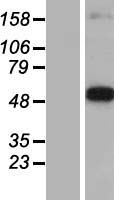 DOPA Decarboxylase (DDC) Human Over-expression Lysate