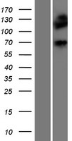 Dystrophia myotonica protein kinase (DMPK) Human Over-expression Lysate