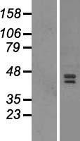 JMJD6 Human Over-expression Lysate