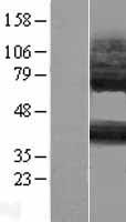 GPR105 (P2RY14) Human Over-expression Lysate