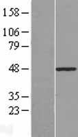 PLAGL1 Human Over-expression Lysate