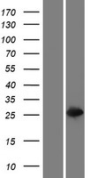 Glutathione S Transferase theta 2 (GSTT2B) Human Over-expression Lysate