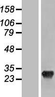 SHISA3 Human Over-expression Lysate