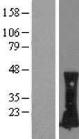 RHOC Human Over-expression Lysate