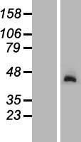 NGDN Human Over-expression Lysate