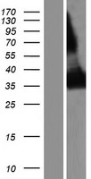 CD1E Human Over-expression Lysate