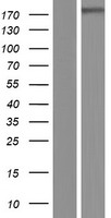 LTBP4 Human Over-expression Lysate