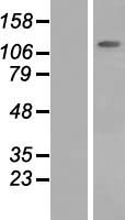 SLC12A6 Human Over-expression Lysate