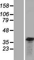 Gemin 8 (GEMIN8) Human Over-expression Lysate