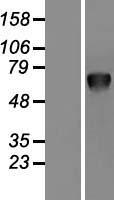 PSAP Human Over-expression Lysate