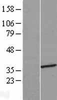 HMGCLL1 Human Over-expression Lysate