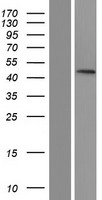 PTPN20A Human Over-expression Lysate