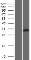 PGP Human Over-expression Lysate