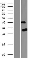 PTPN20B (PTPN20) Human Over-expression Lysate