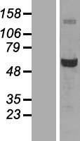Glucose 6 Phosphate Dehydrogenase (G6PD) Human Over-expression Lysate