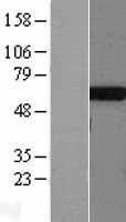TBXAS1 Human Over-expression Lysate