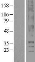 Thromboxane A2 receptor (TBXA2R) Human Over-expression Lysate